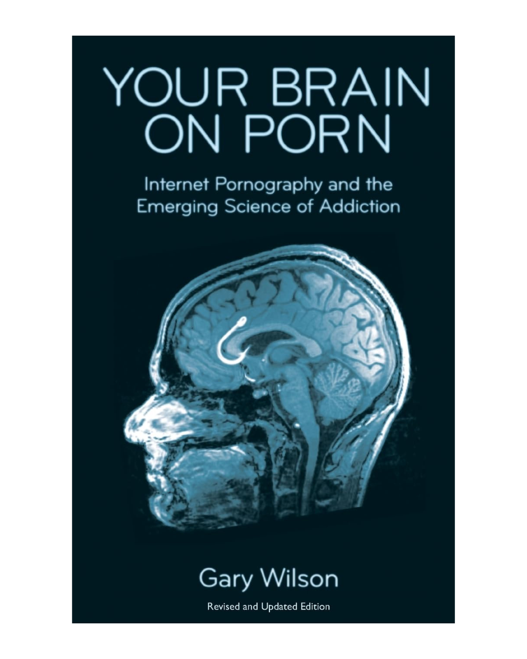 Your Brain on Porn